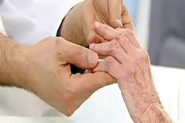 Rheumatoid Arthritis, Ankylosing Spondylitis, Osteoarthritis